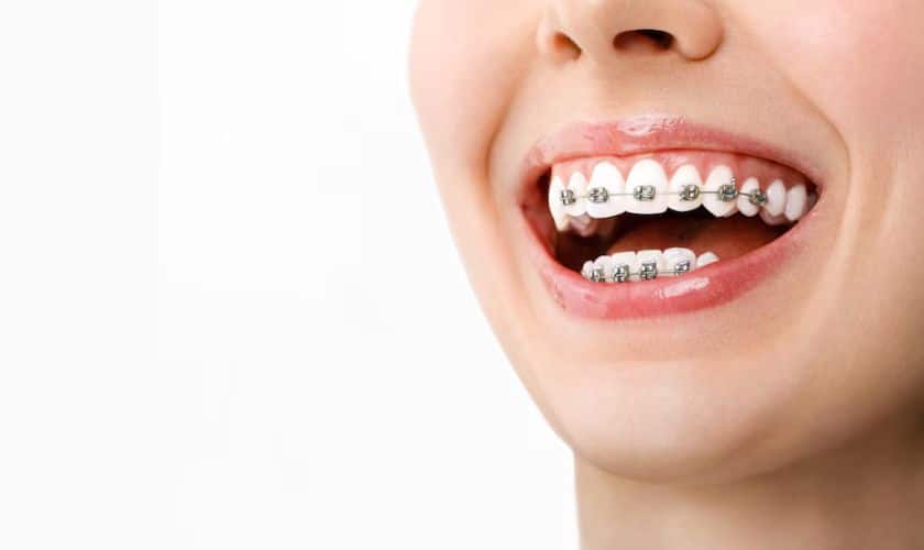 dentist gainesville tx