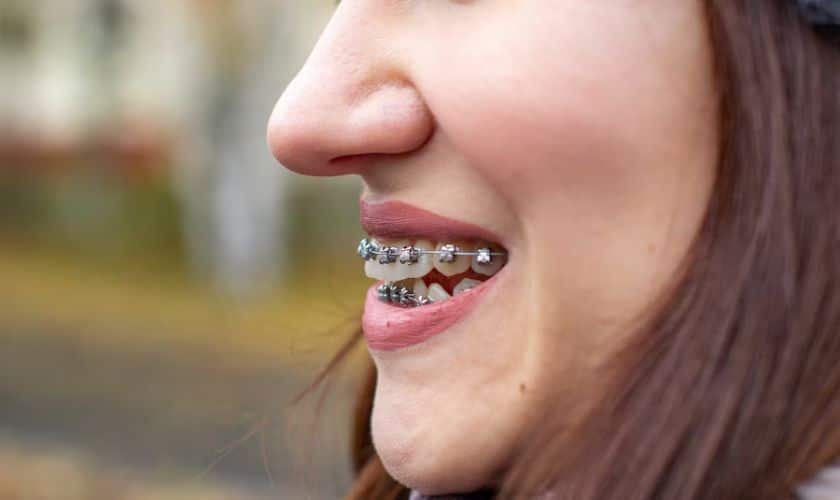 gainesville orthodontics