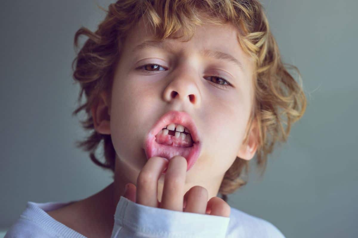 Emergency-Dentist-Gainesville