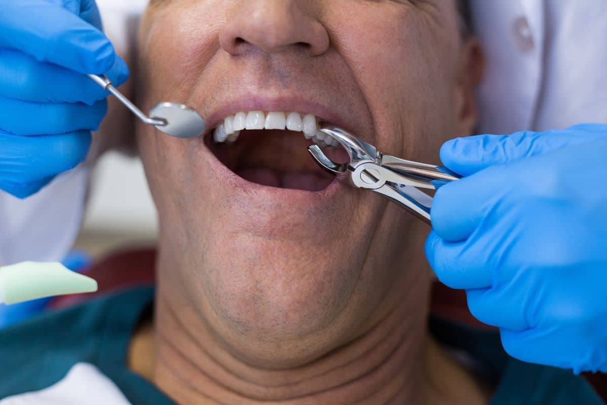 Tooth Extraction in Gainesville
