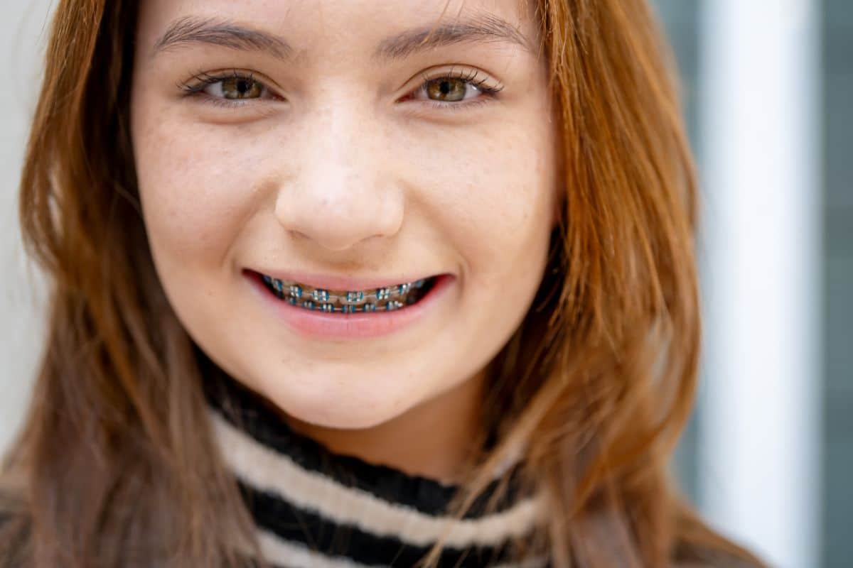 Adult Braces in Gainesville