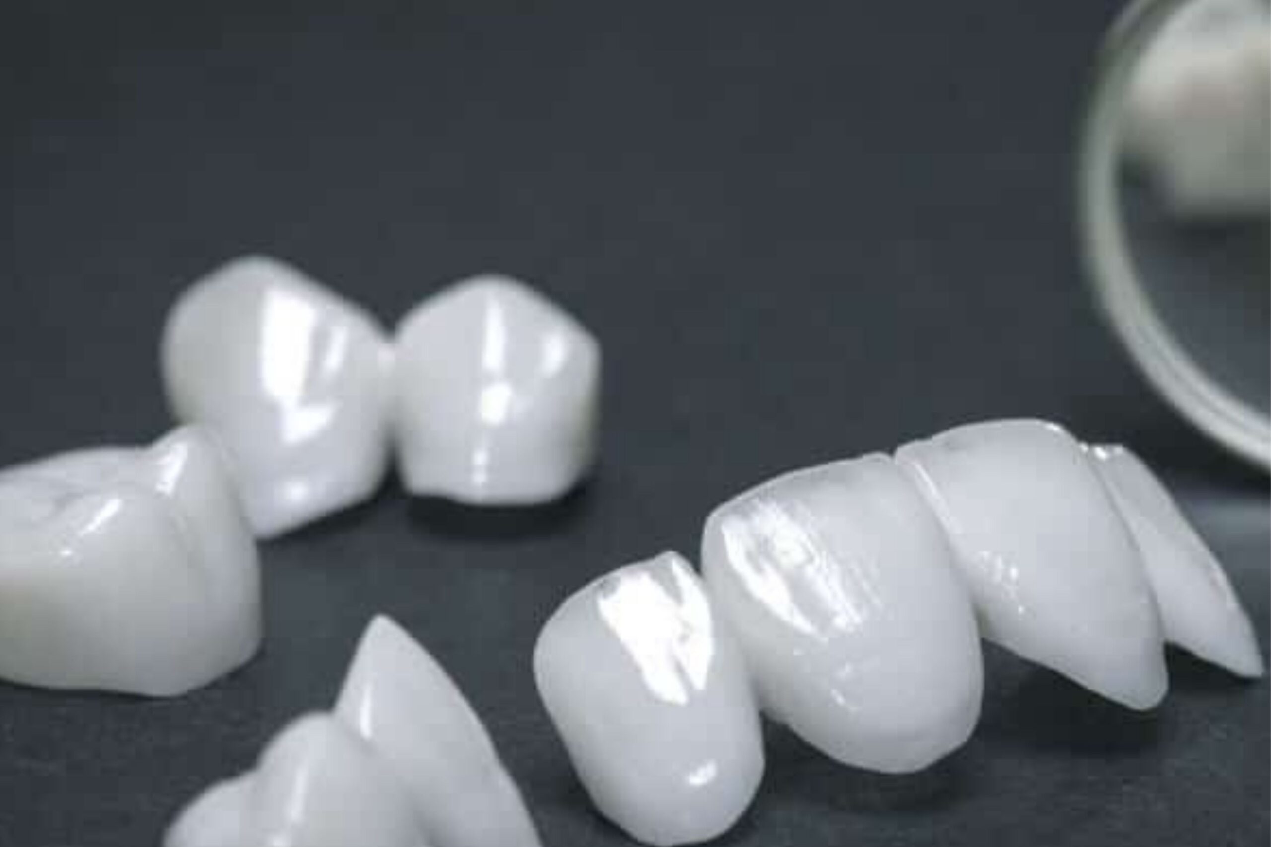 Close-up of dental Lumineers – keeping your smile bright with Lumineers in Gainesville, TX