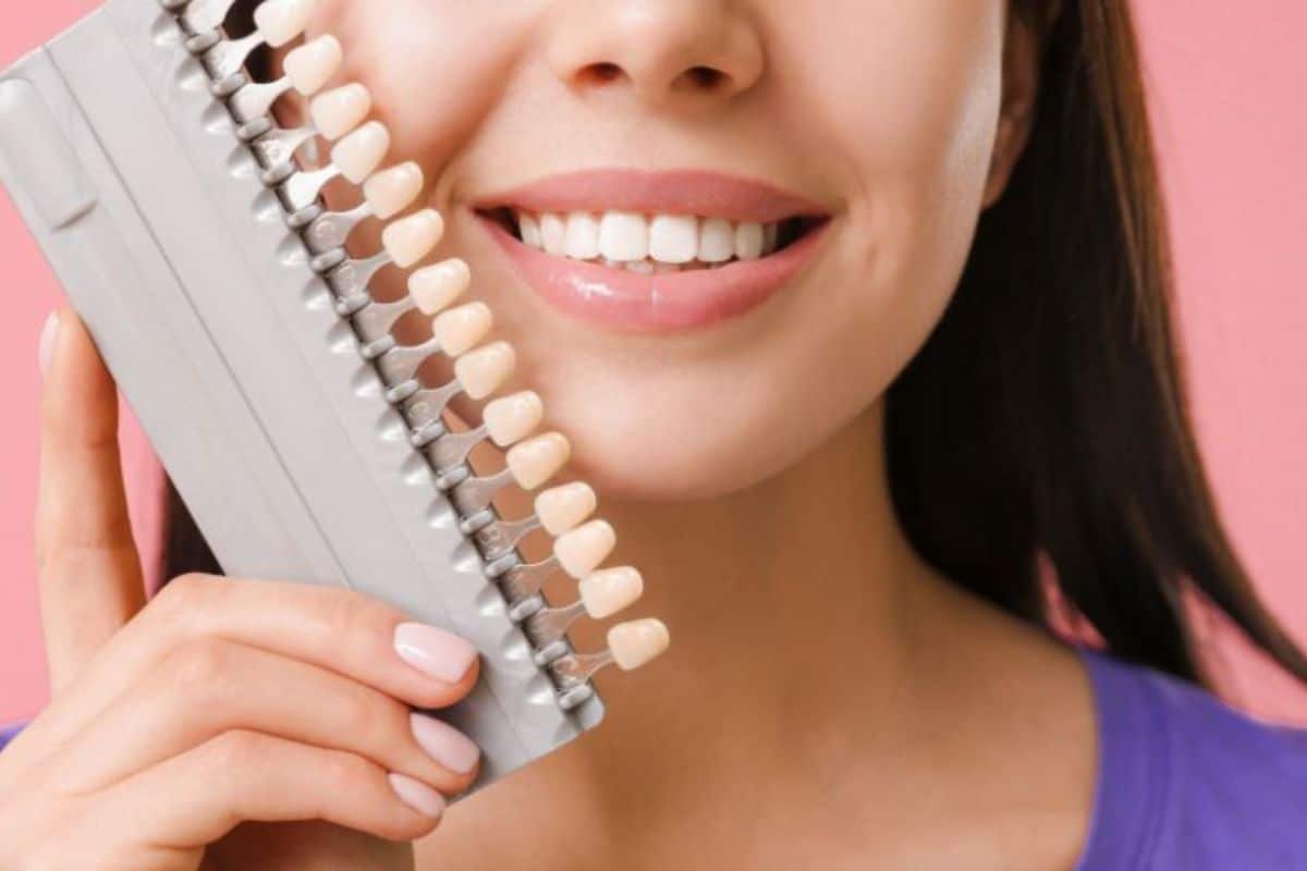 Veneers | Cosmetic Dentistry in Gainesville, TX