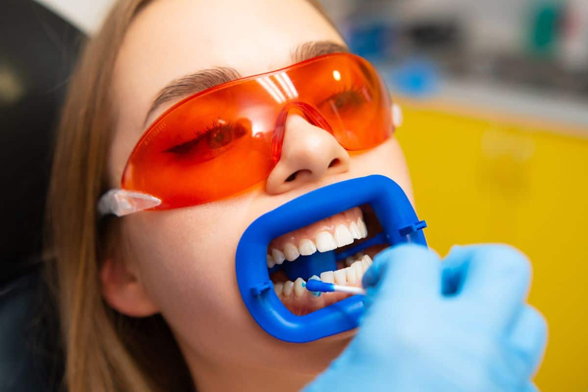 teeth-whitening-gainesville-tx