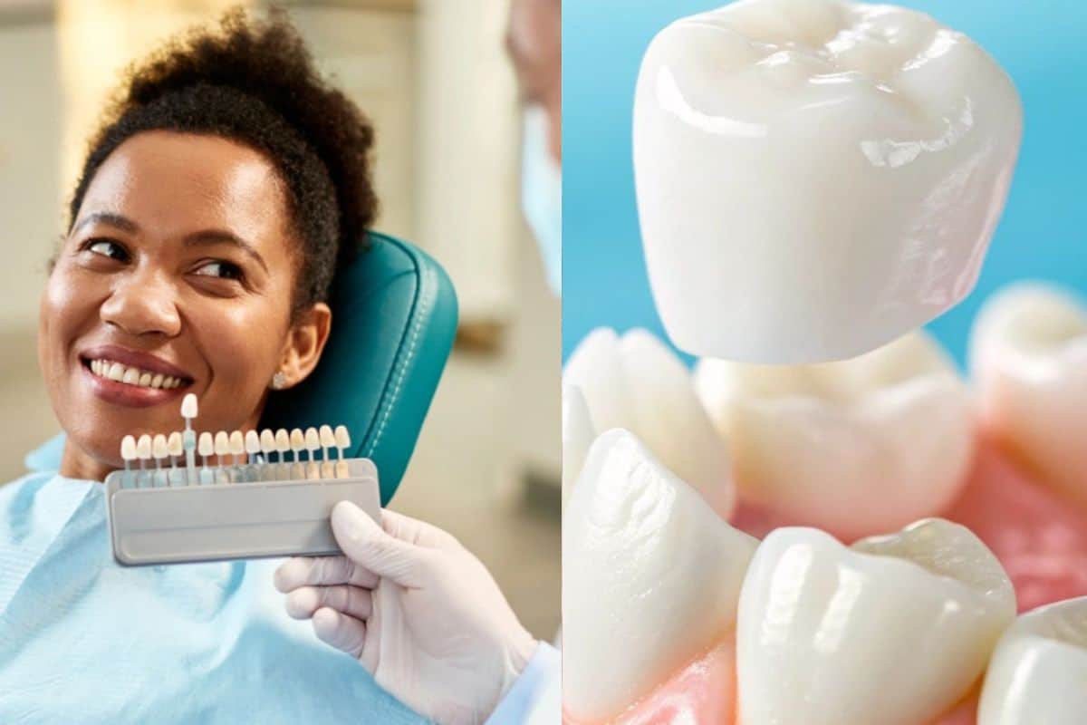 Featured image for “Veneers vs. Crowns: Which Is Better?”