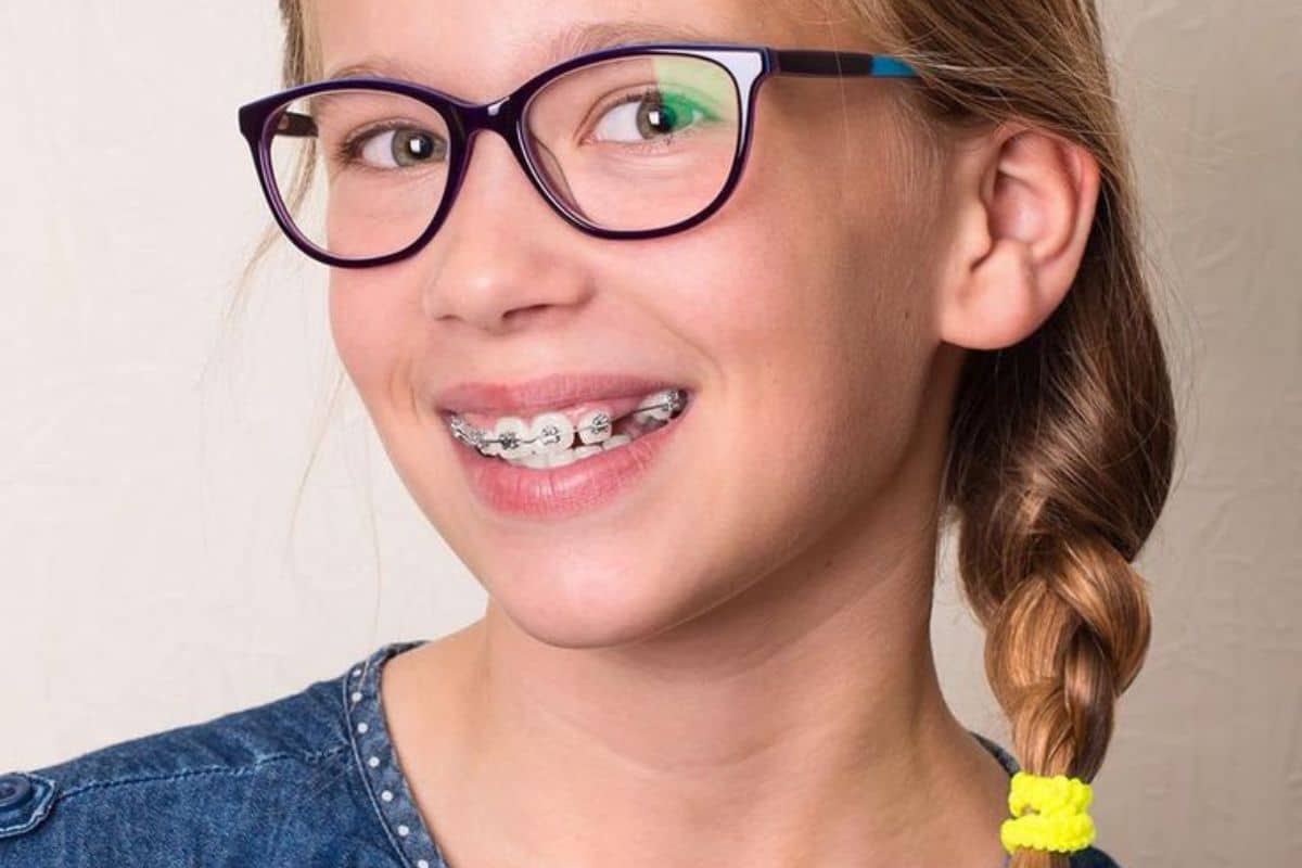 Featured image for “How Do Braces Correct Crossbites in Children?”
