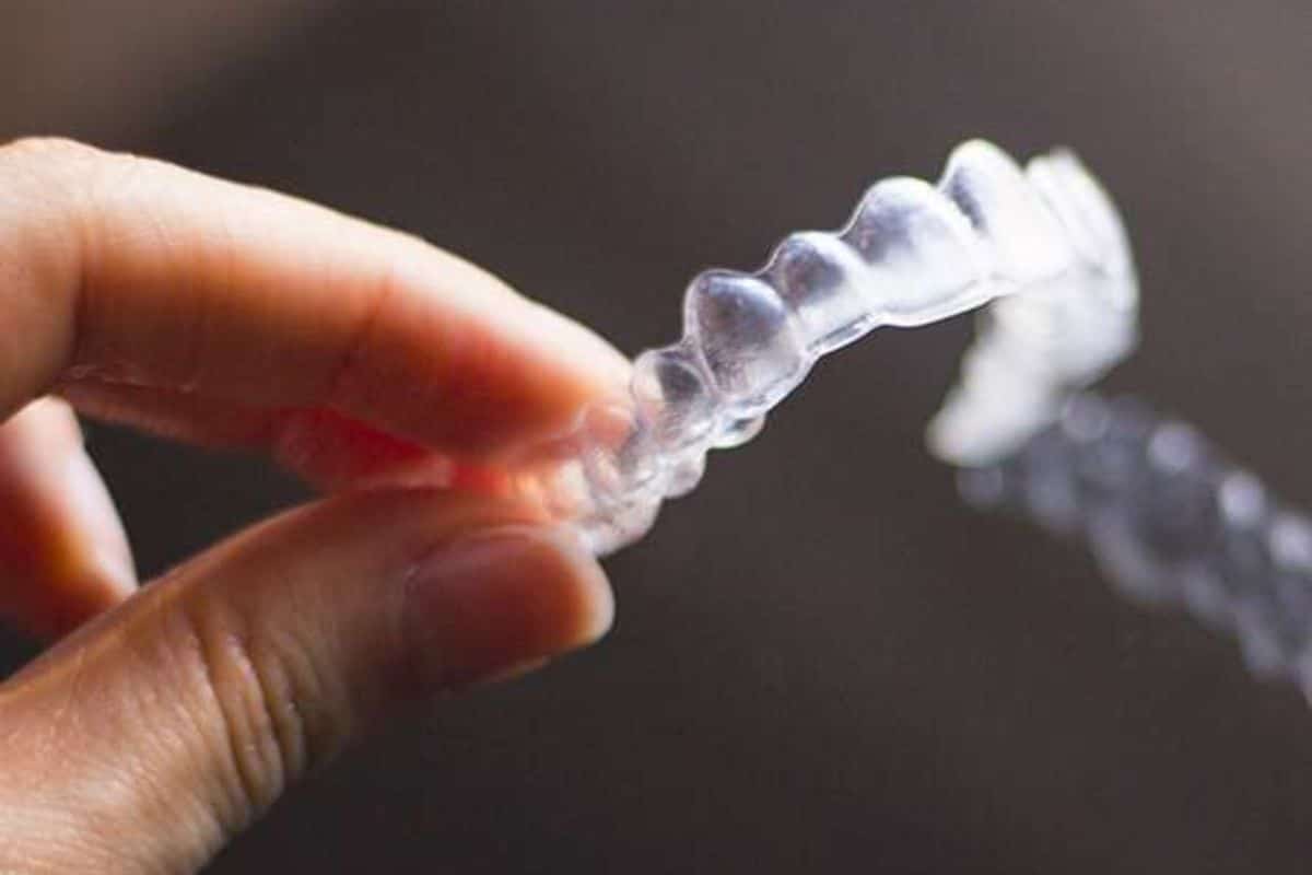 Featured image for “Fixing Posterior Crossbites with Invisalign in Gainesville”